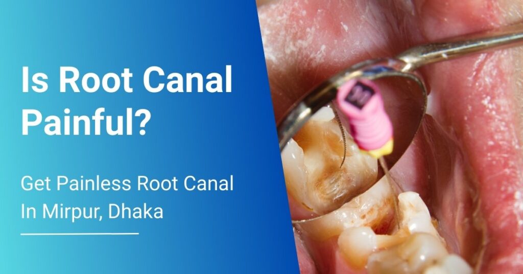 is root canal painful
