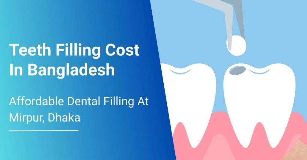 Teeth Filling Cost In Bangladesh: Affordable Dental Filling At Mirpur, Dhaka