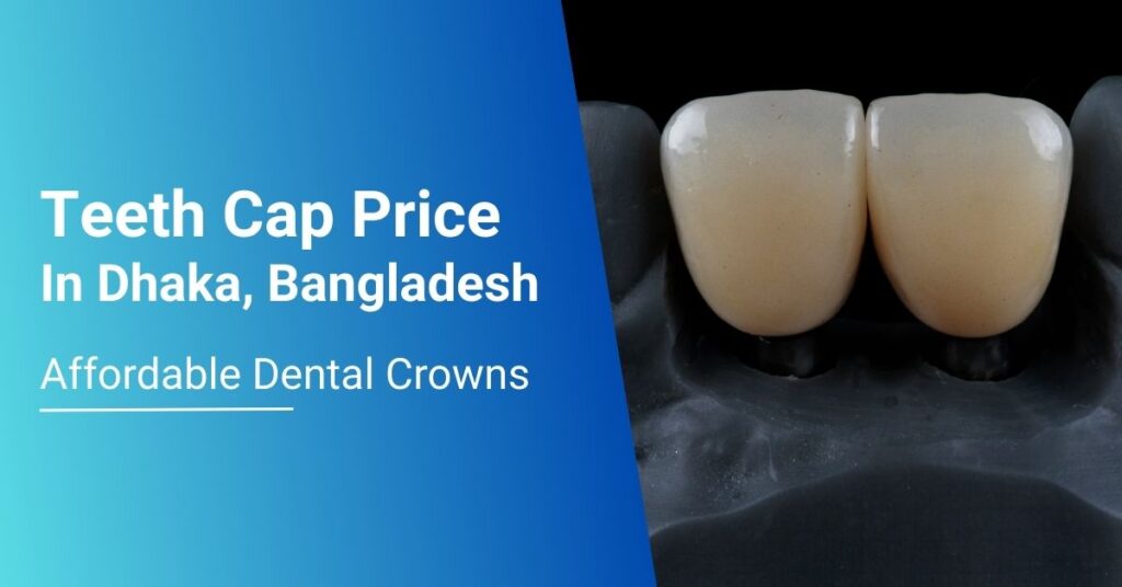 Teeth Cap Price In Bangladesh – Affordable Dental Crowns