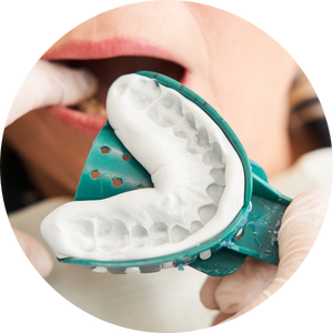 impression taking at Mirpur lumika dental