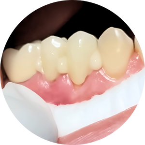 tooth cap in mirpur