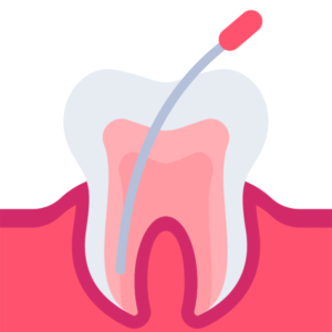 root canal treatment in dhaka