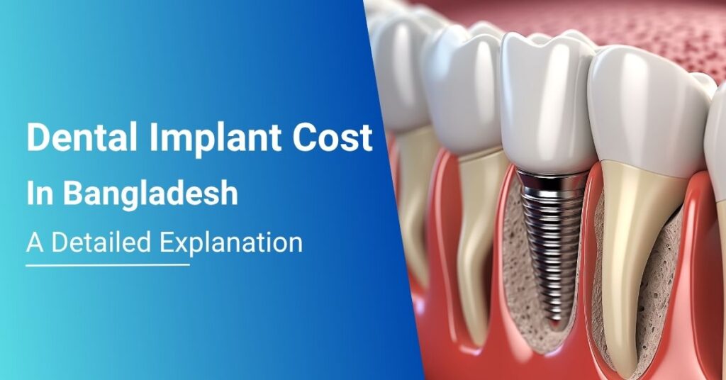 dental implant cost bangladesh