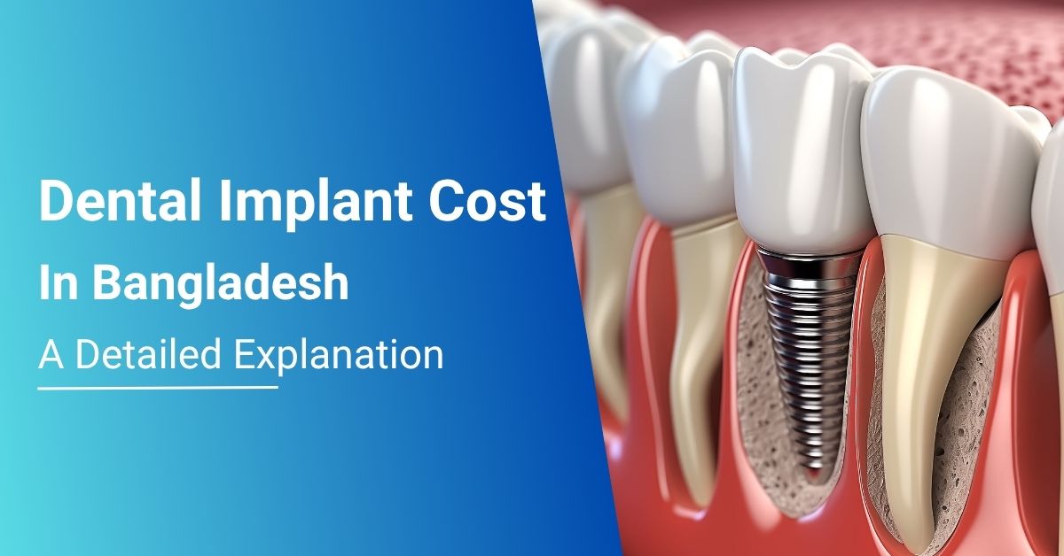 dental implant cost bangladesh