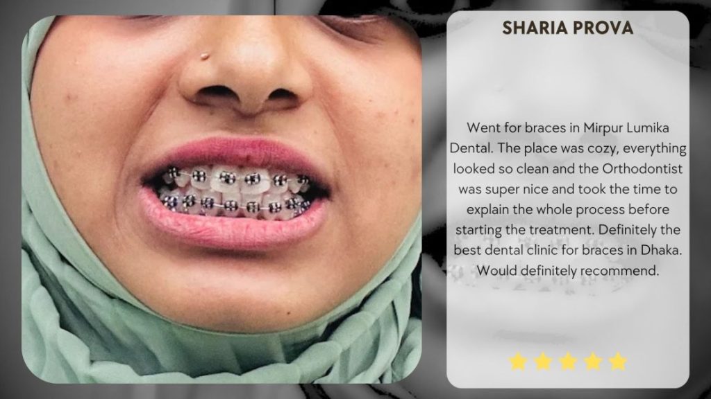braces in mirpur