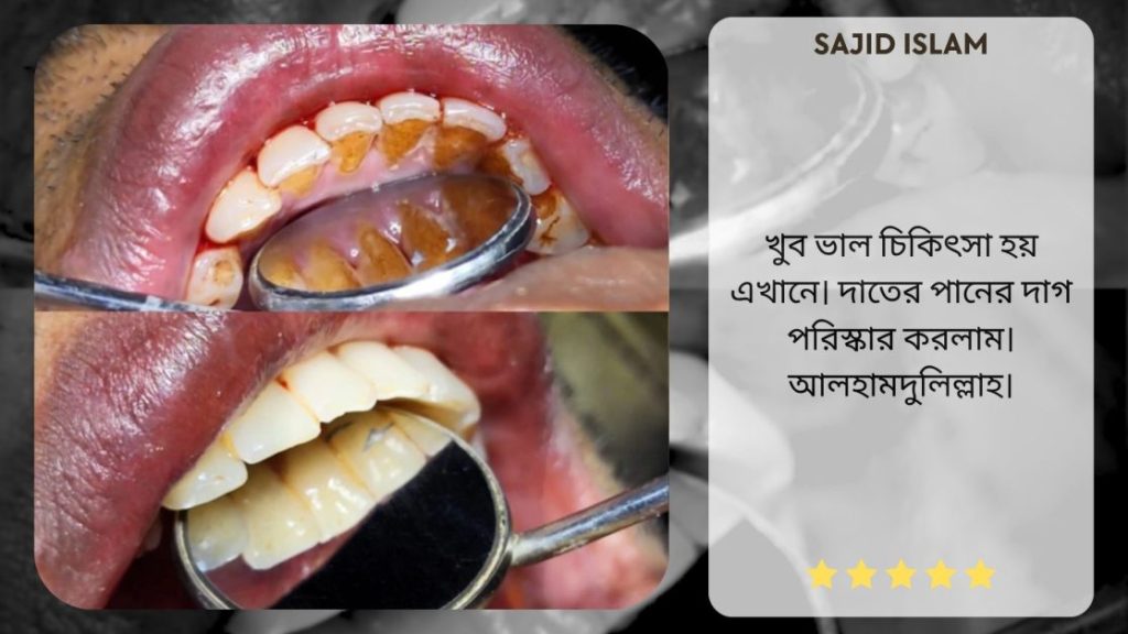 scaling in dhaka